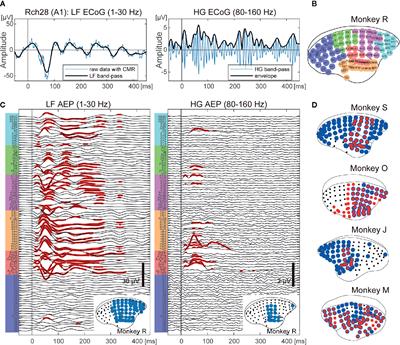 Effects of Ketamine Administration on <mark class="highlighted">Auditory Information</mark> Processing in the Neocortex of Nonhuman Primates